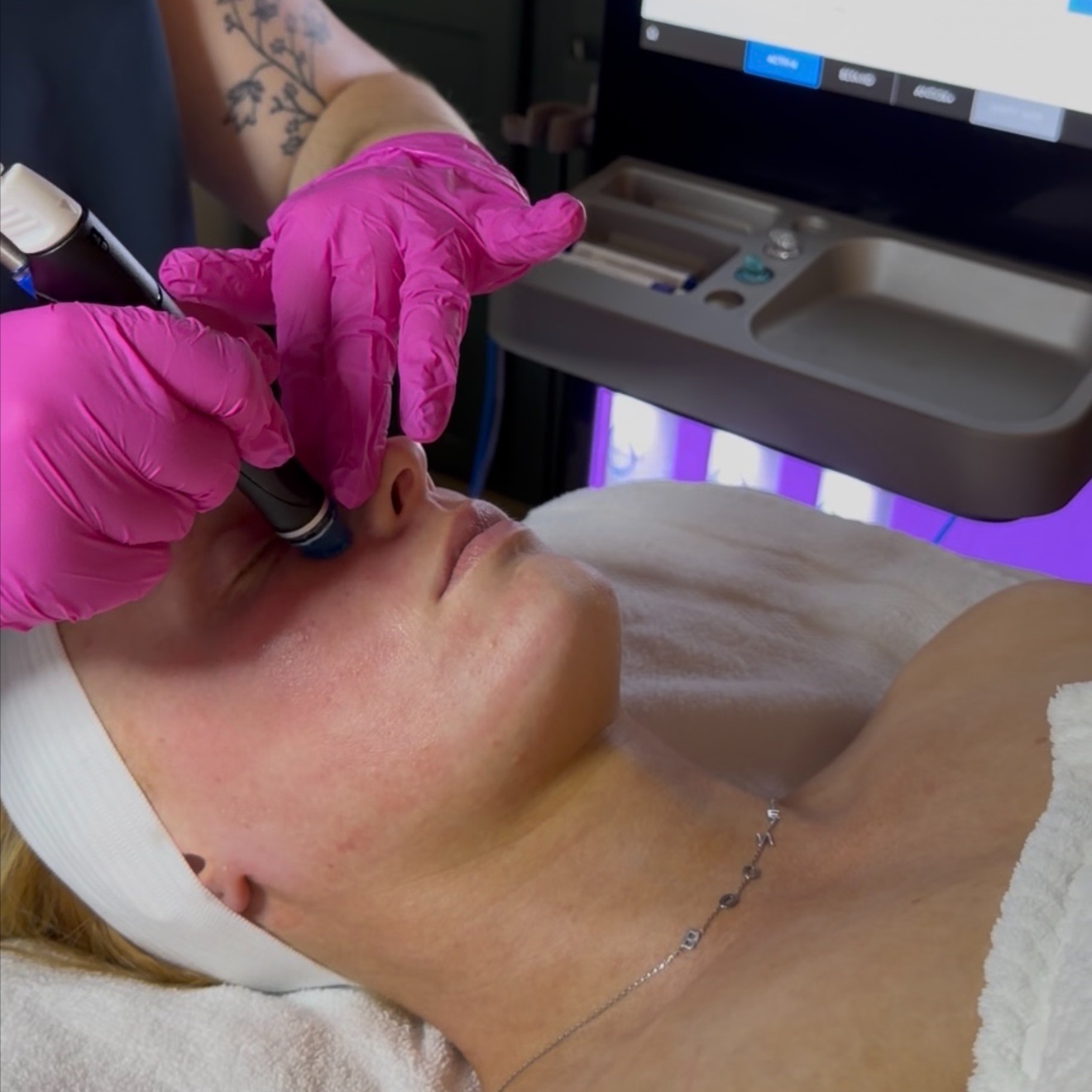 Platinum Hydrafacial at Luxe Lineage Esthetics in Christiansburg, VA