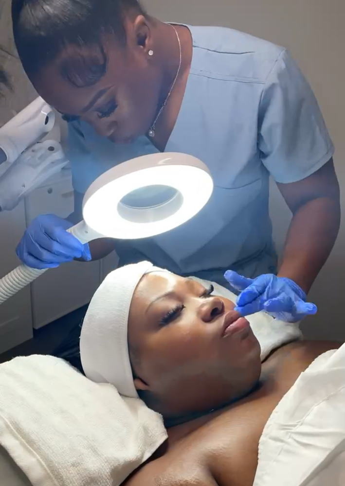 New Client Consultation(In-Clinic) at Face It Aesthethics in Dothan, AL