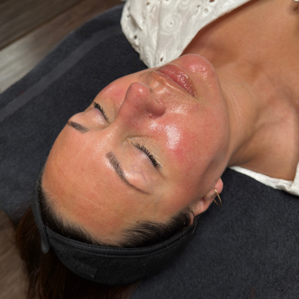ADVANCED SKIN TREATMENTS (PEELS) at Etched and Elegant in Corona, CA