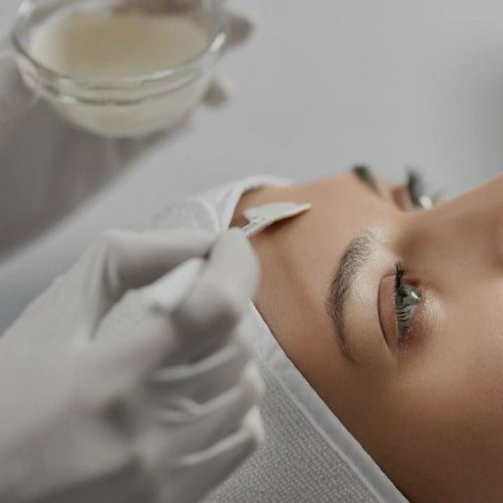 Gentle Peel at Le Esthetics in Houston, TX