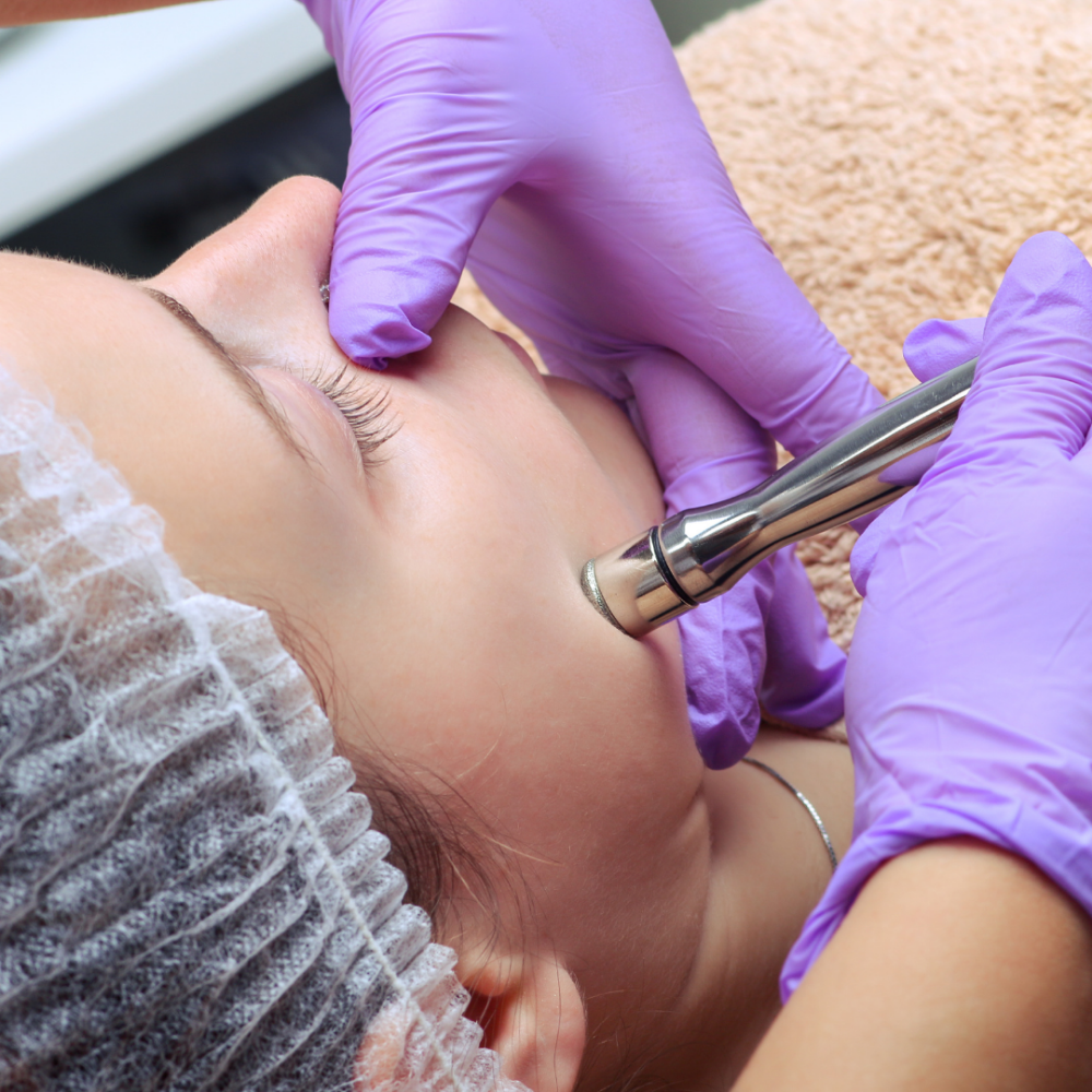 Microdermabrasion Facial