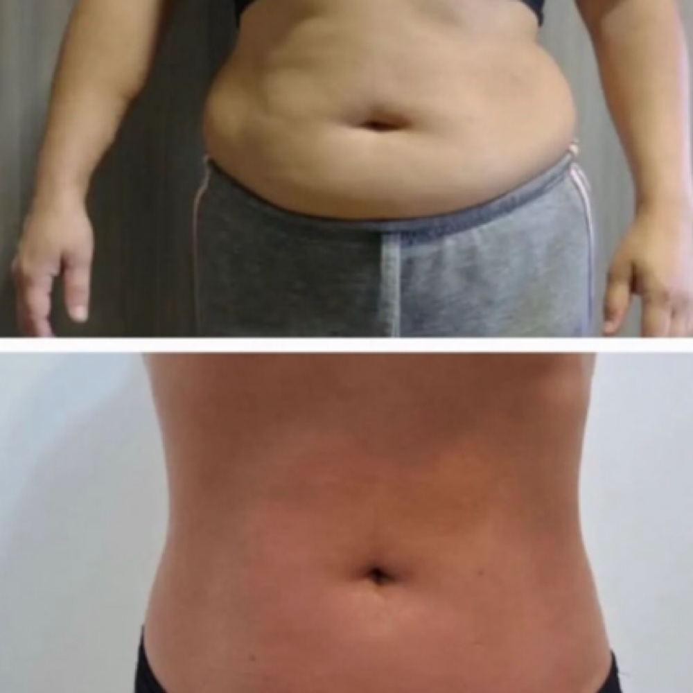 Brazilian 360 Body Wrap