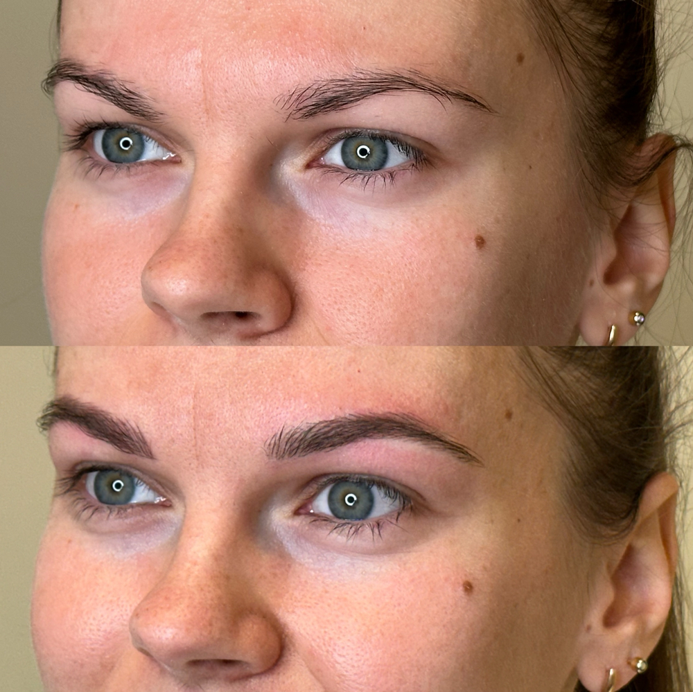 Nanobrows