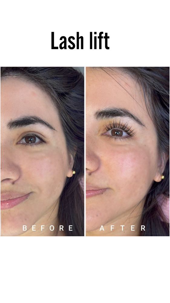 Lash Lift