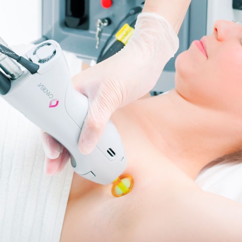 Laser Hair Removal Medium Area