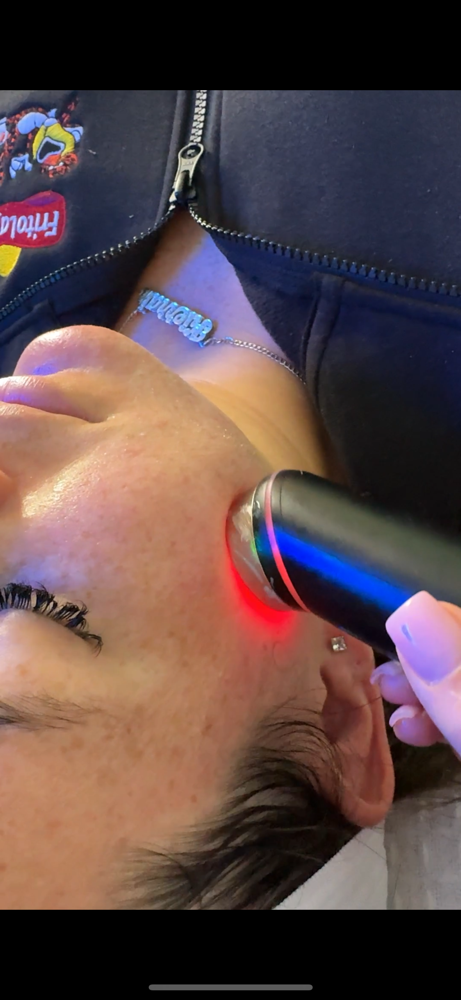 Radio Frequency Facial