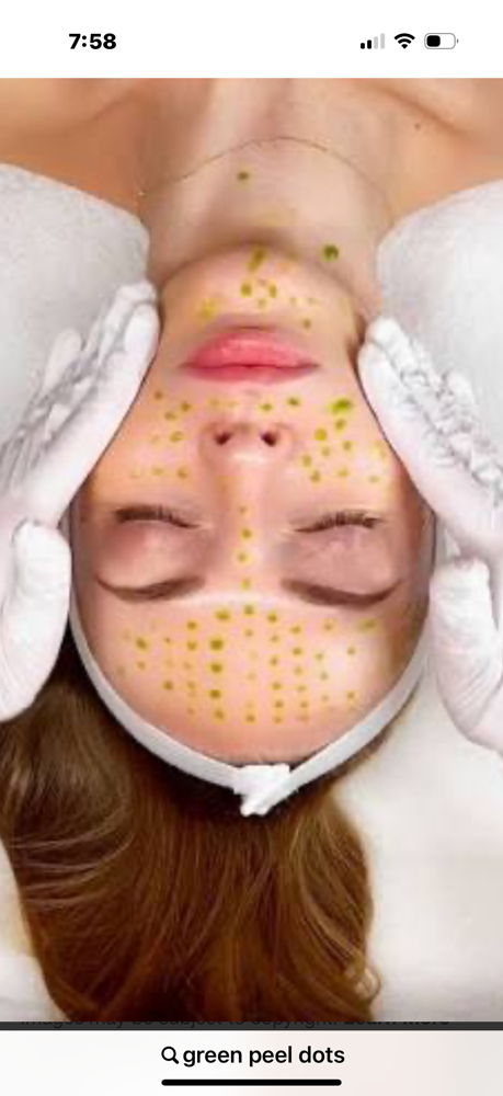 BioRe Peel ( no peeling – peel) at Marina Novak in North Palm Beach, FL