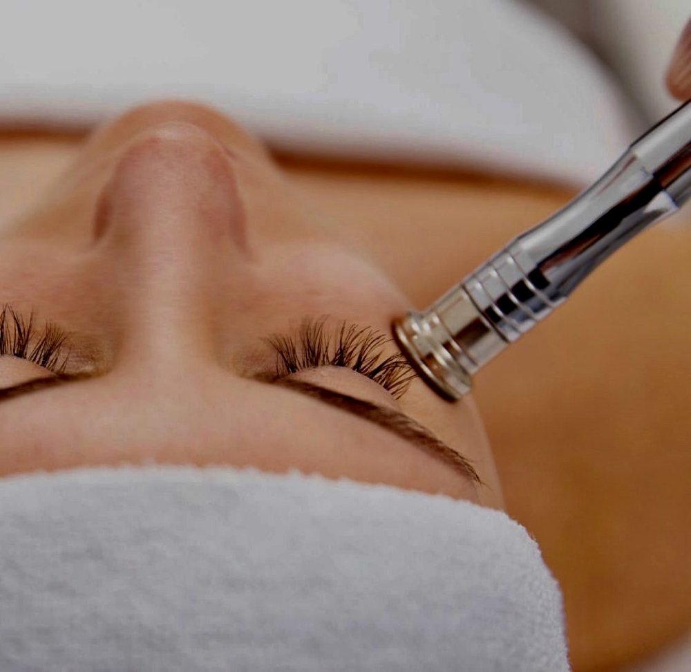 Microdermabrasion