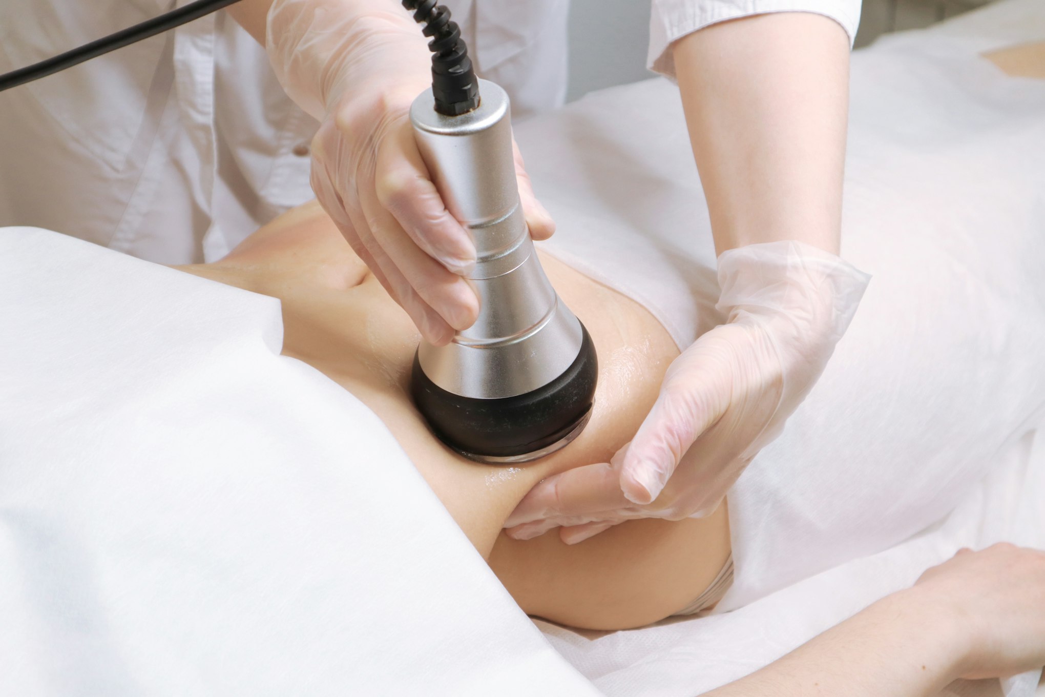 Cavitation