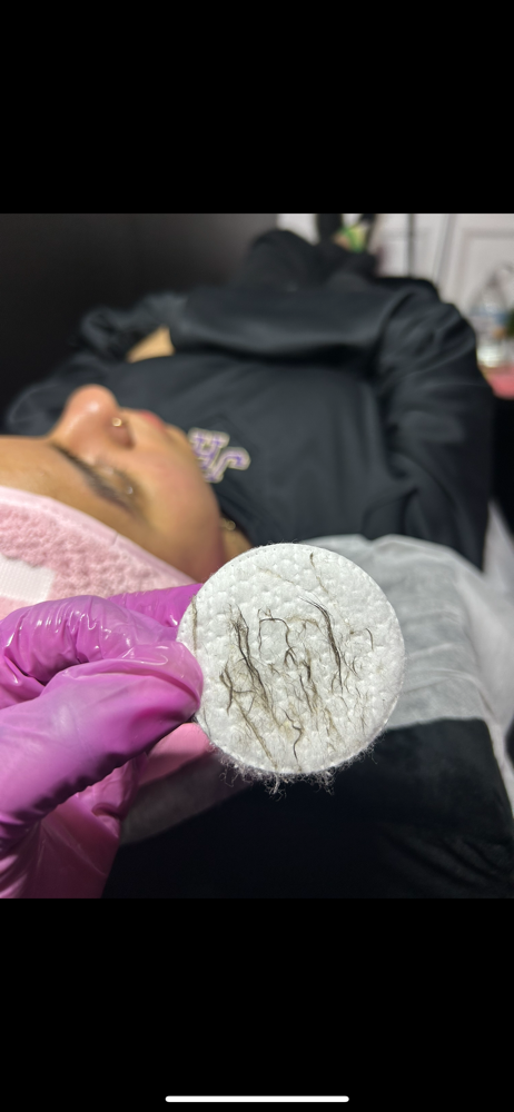 Dermaplaning facial