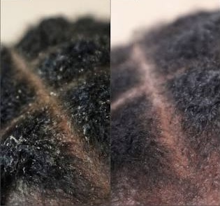 Invigorating Scalp Treatment at ChariseRenee’J Hands of A Goddess in Kettering, MD