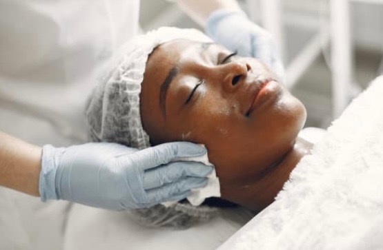 Back Microdermabrasion