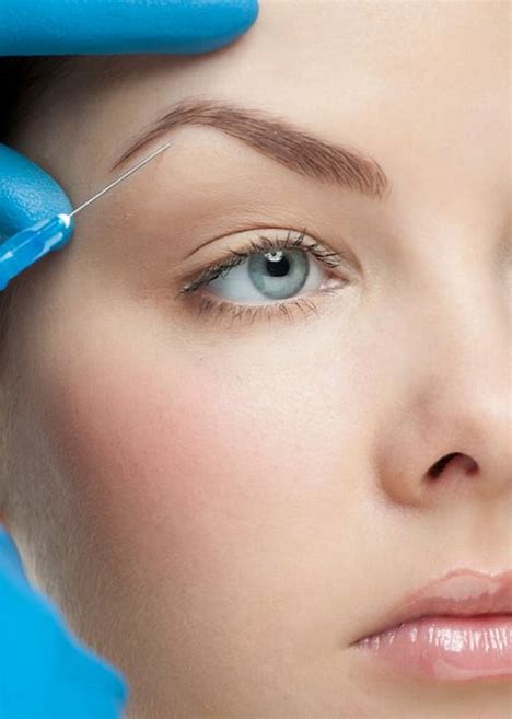 Non-surgical Brow Lift