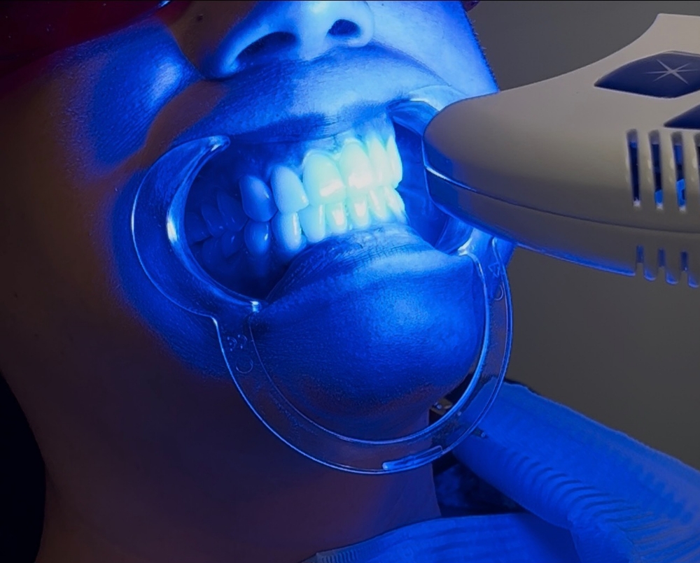 Signature Whitening
