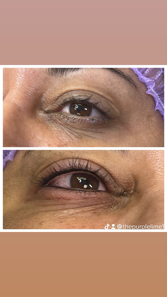 Eyelash Line  Enhancement