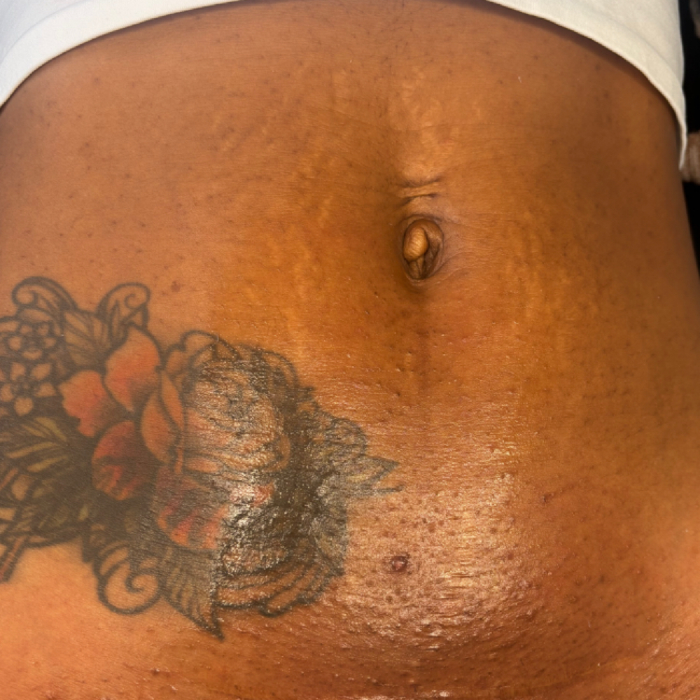 Tummy Strip Wax at Naturally Empressed in Summerville, SC