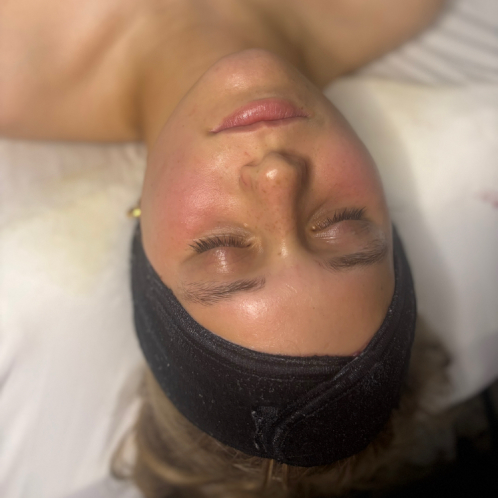 Teen Facial at Radiant Glo Aesthetics in Ottawa, KS