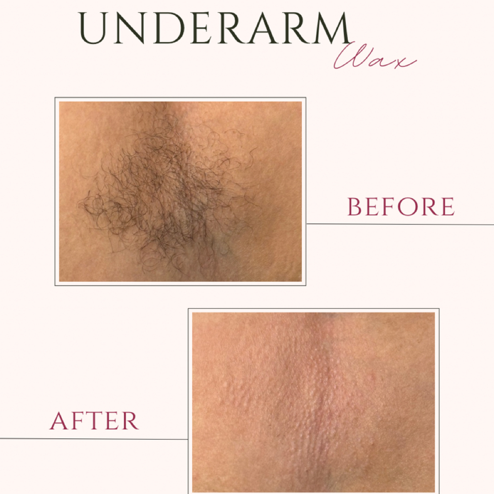 Underarm at The Beauty Collective in Des Moines, IA