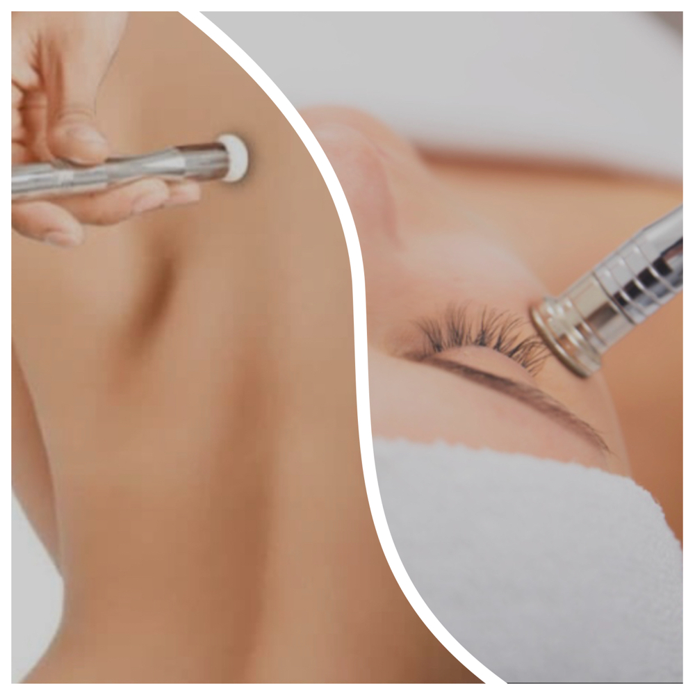 ADD  Microdermabrasion