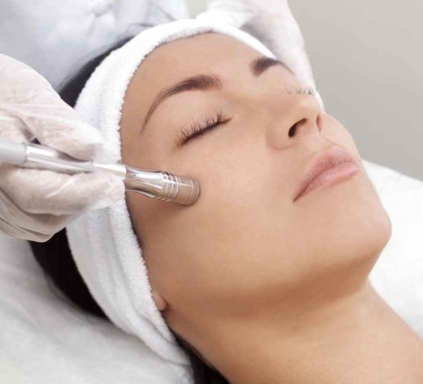 Microdermabrasion Facial
