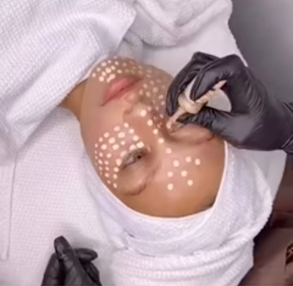 BB Glow Facial