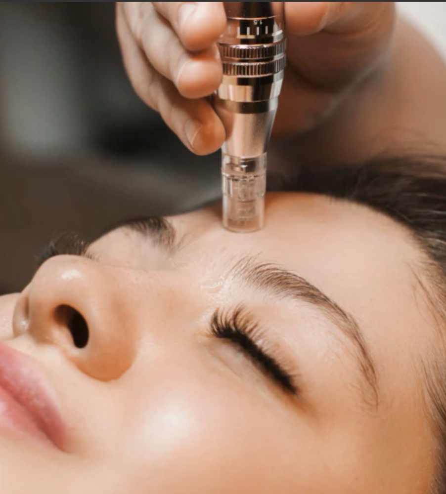 Nano Needling Face Neck & Chest