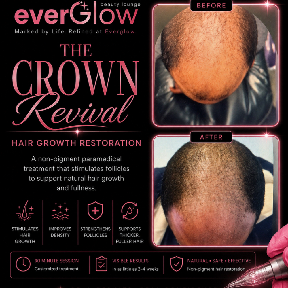 The Crown Revival:Hair Regeneration at Ever Glow Beauty Lounge in Lubbock, TX