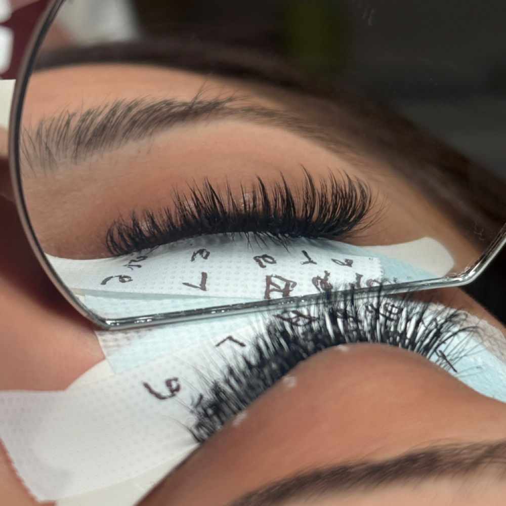 Patch Test at Villa Esthetics in Bryan, TX