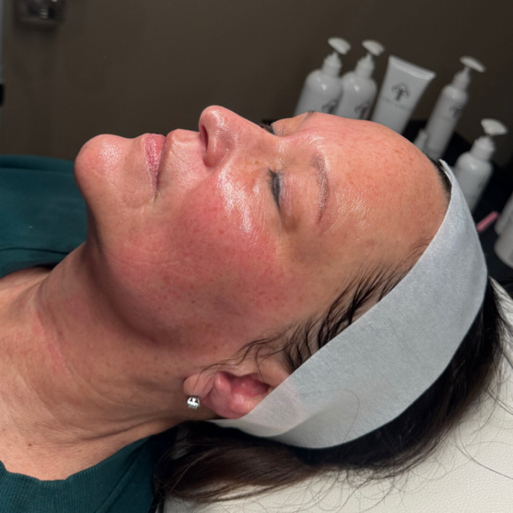 Smooth & Radiant Luxe Facial at SKIN BY HAYLEE in Rochester, MN