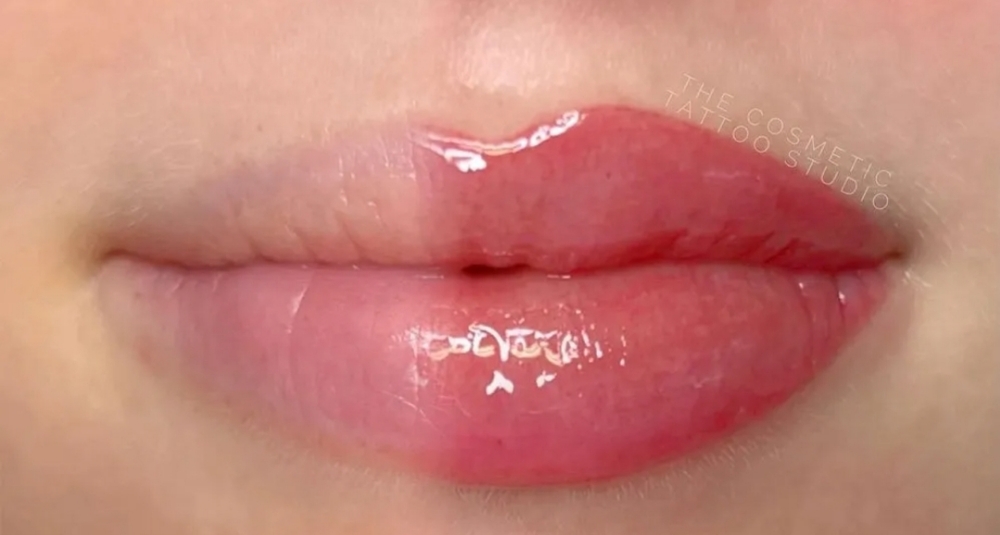 Hydra Lips at Skin & Toxx in Houston, TX