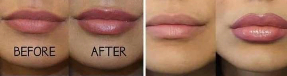 Lip Mask Plus Plumper