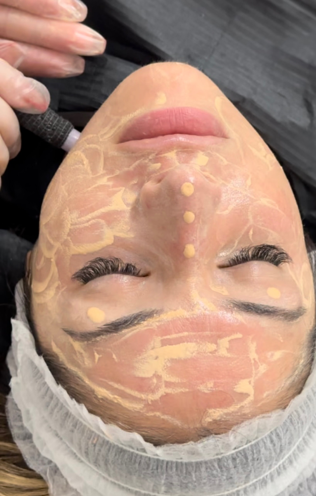 BB Glow Facial Treatment