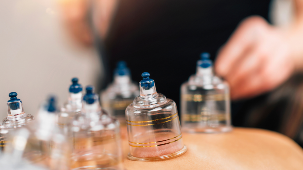 Cupping Therapy