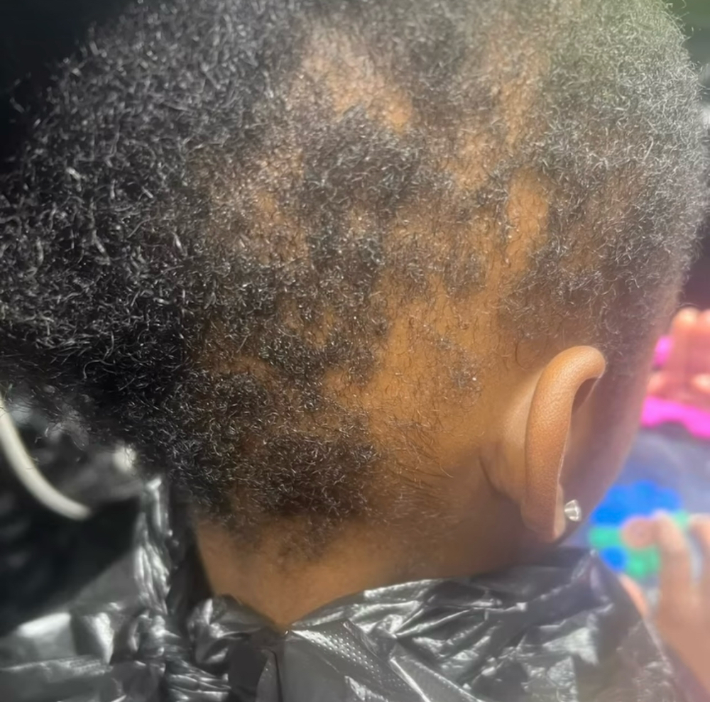 Children With Scalp&Skin Issues