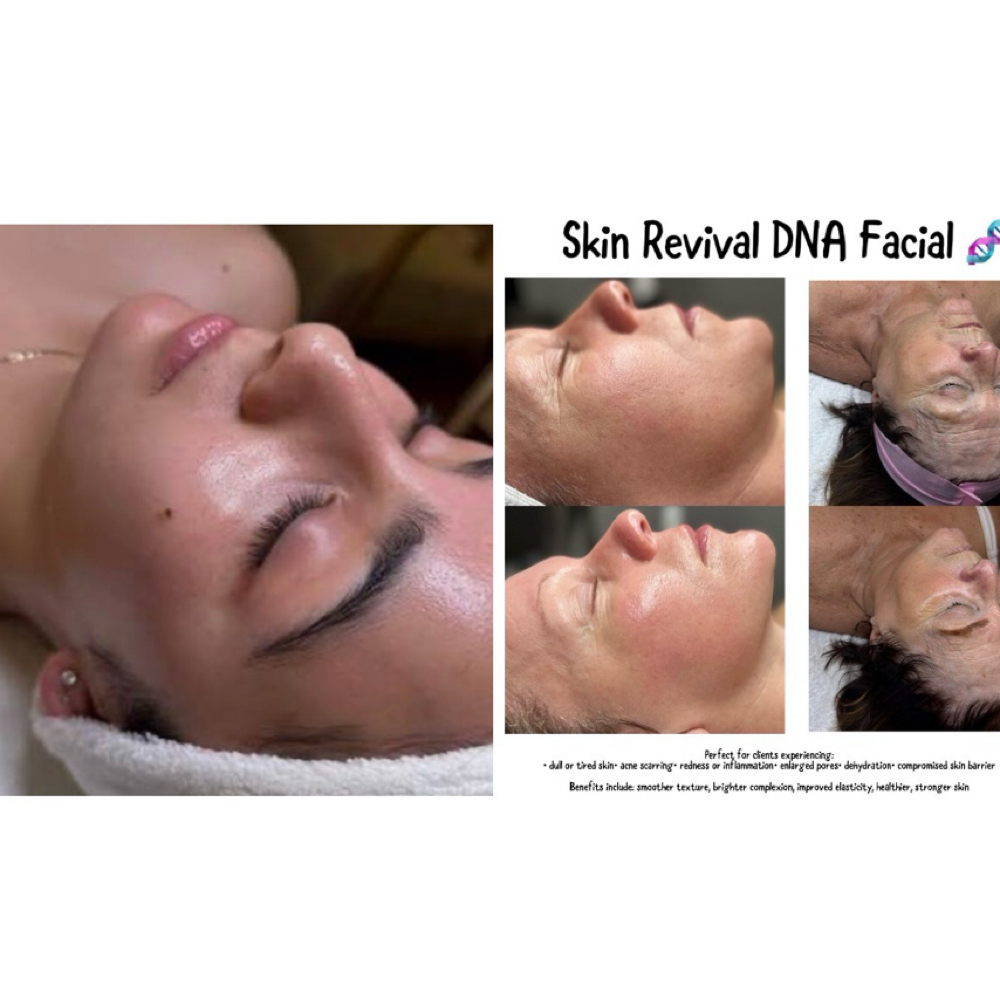 K Beauty Skin Revival & Dermaplane at Her Esthetics in Olean, NY
