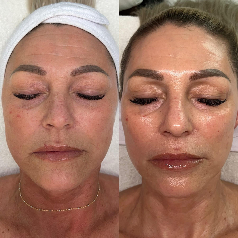 ReBourne Radiance Firming Facial at ReBourne Aesthetics and Wellness in Ridgland, MS