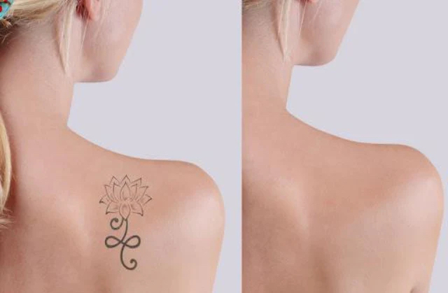 Tattoo Coverage
