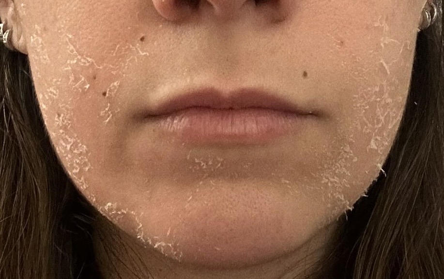 Retinol Seal Add-On