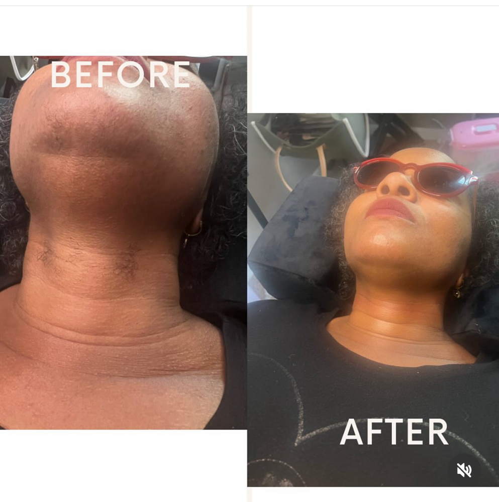 Neck/Chin Wax at BeYou Cosmetics LLC in Columbus, OH