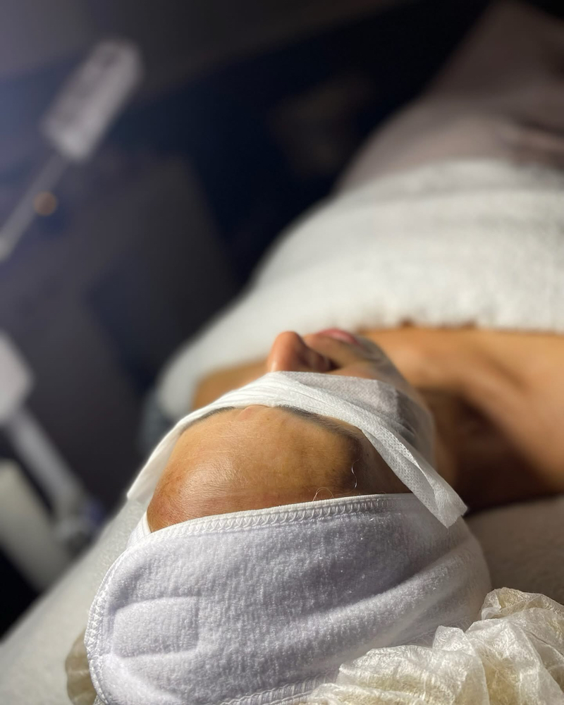 Facial Renewal