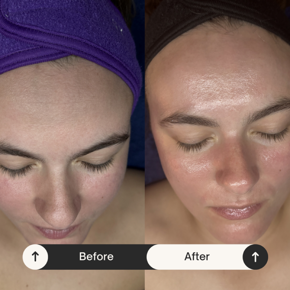Tier 3- Ultimate Custom Facial at Satin Skin Esthetics LLC in Glens Falls, NY