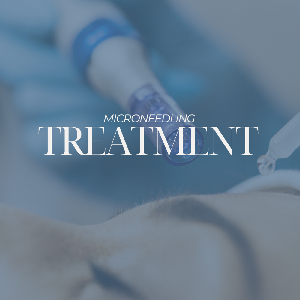 MICRONEEDLING TREATMENT