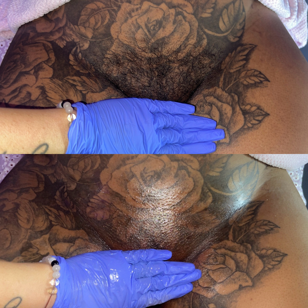 Brazilian Waxing