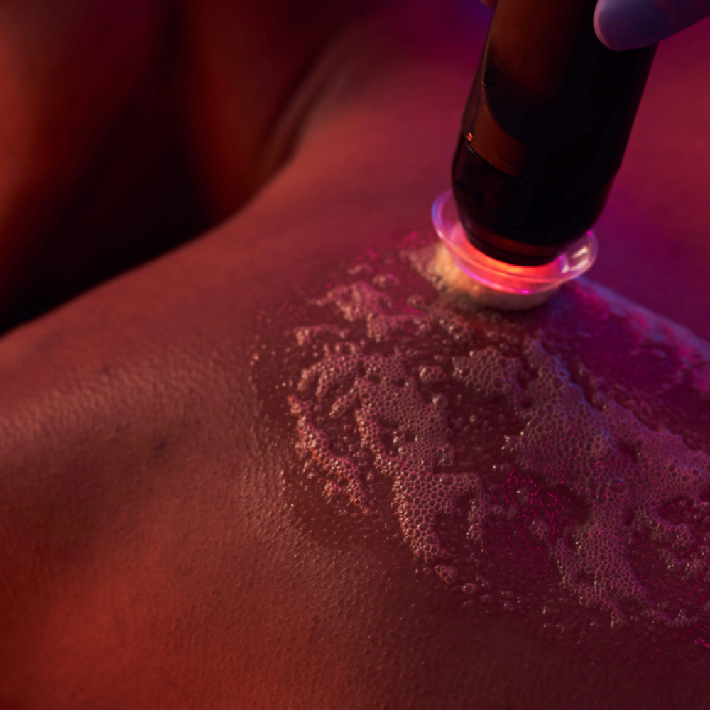 Glo₂ Back Treatment