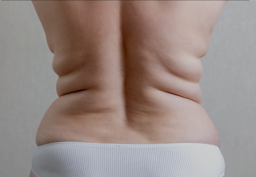 Sculpted Backline Therapy