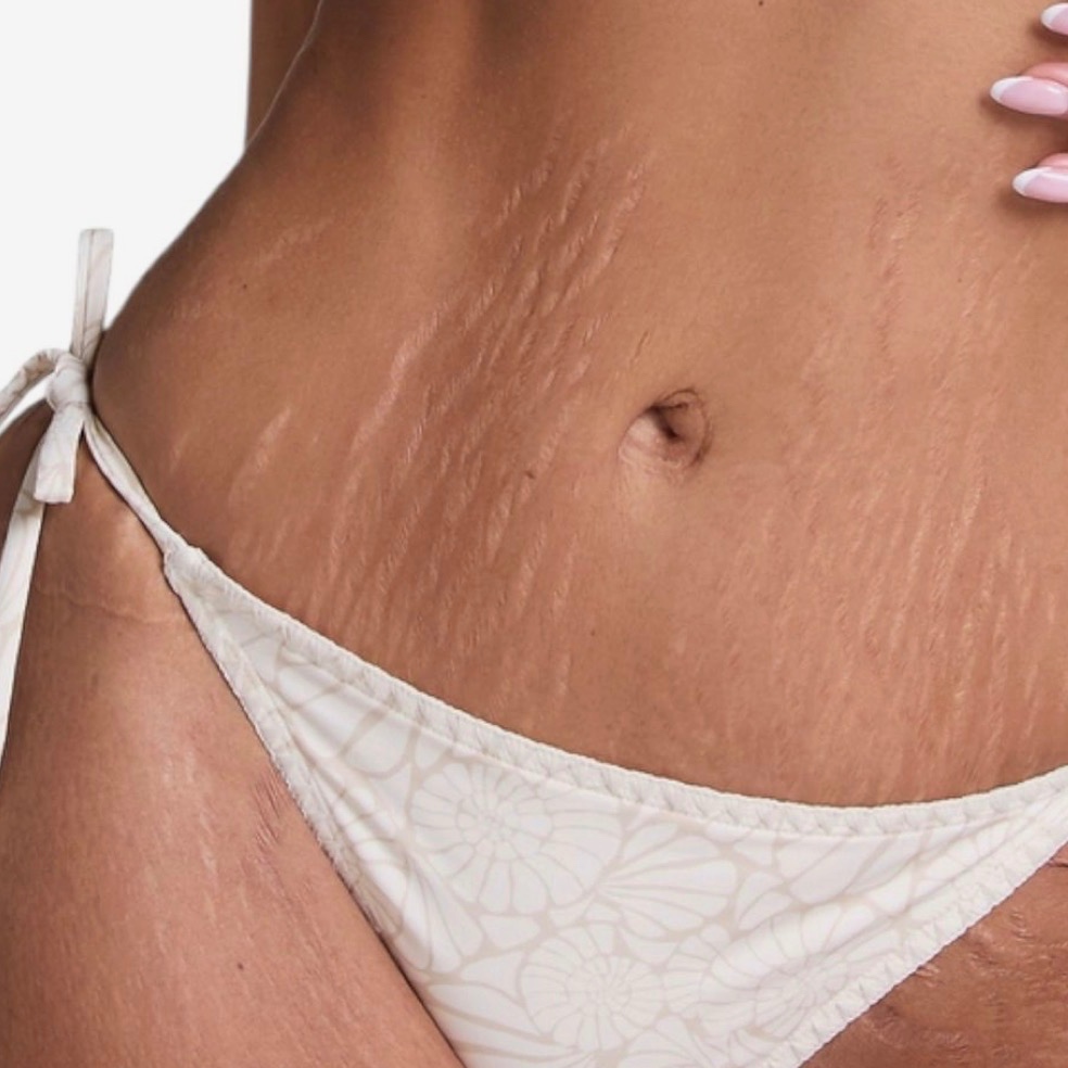 Full Stomach Wax at Bare + Bronzed in Fort Worth, TX