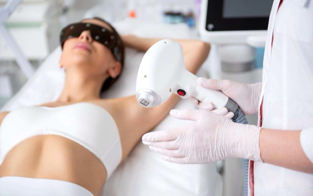 Depilación LASER DIODO