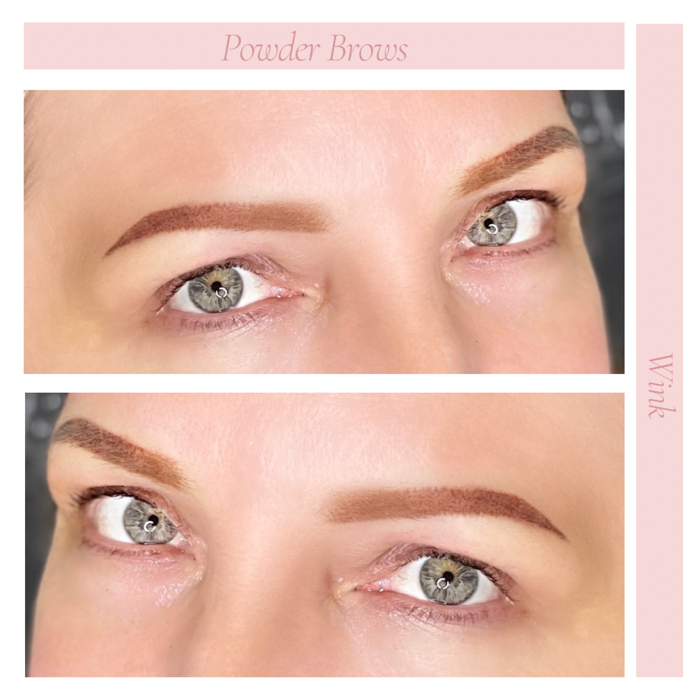 6-8 Week Brow Follow-up