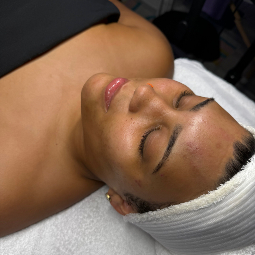 Corrective Treatment Facial at Moonlight Aesthetics in pensacola, FL