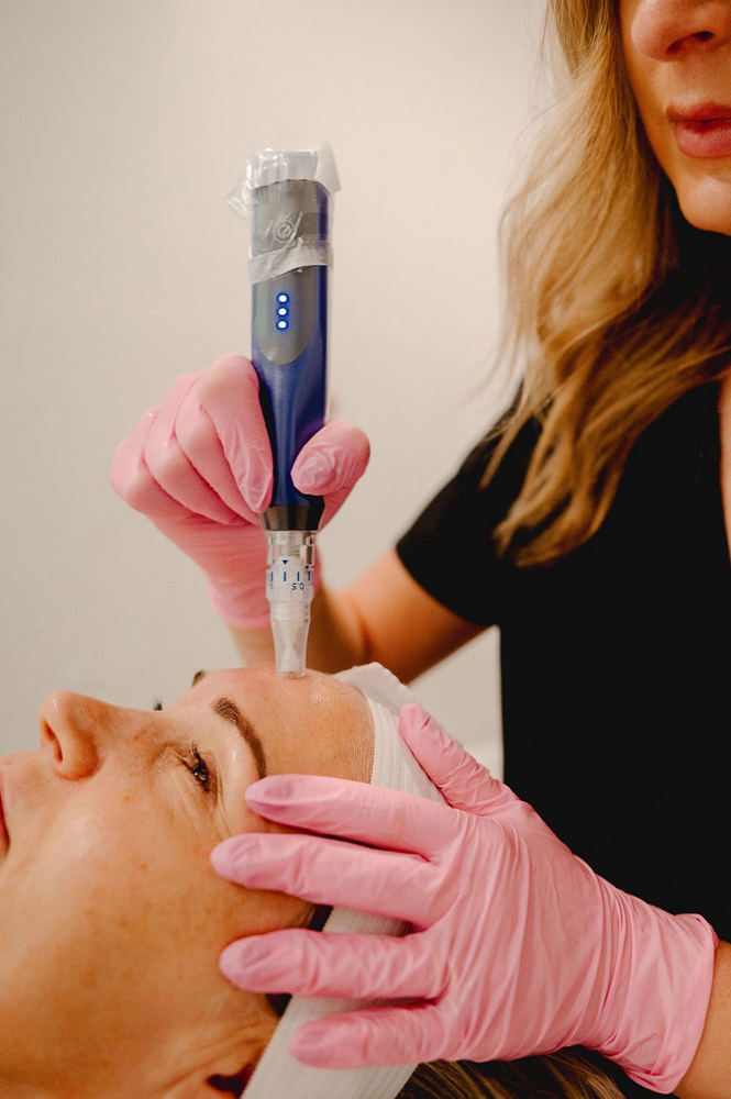Collagen Induction Therapy